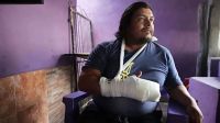 El duro relato del remisero que sufrió una amputación tras ser atacado a machetazos