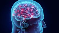 Tumores cerebrales: ¿cuáles son los signos de alerta?